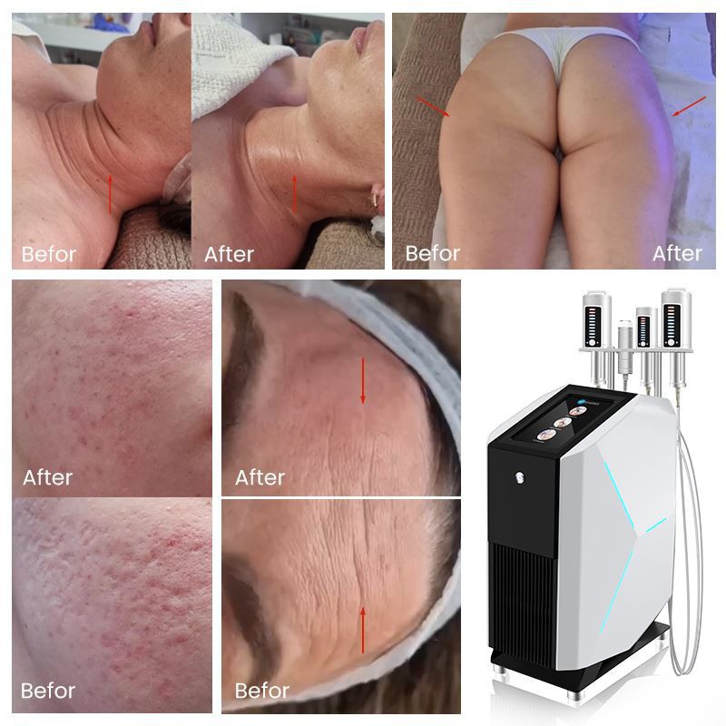 033dcccf-69aa-4a30-9e8f-b84f95aeb213